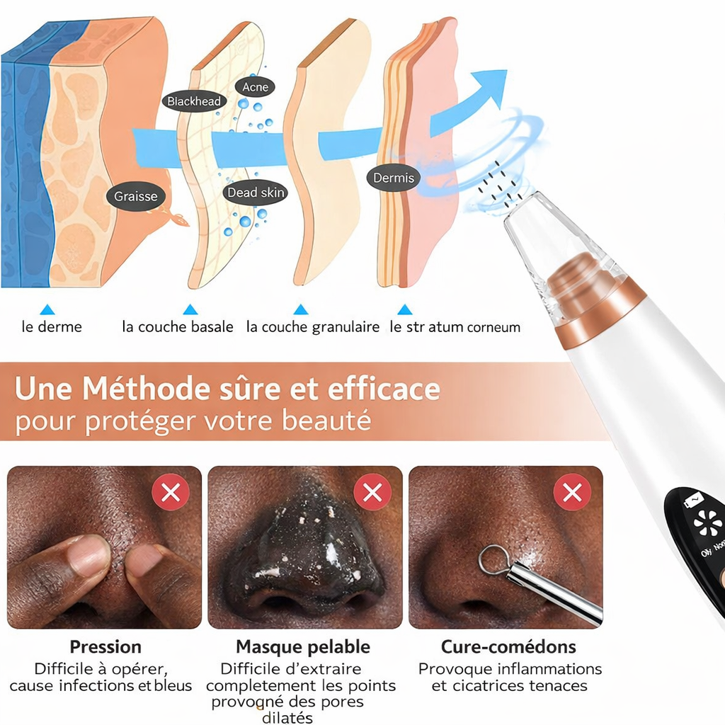 Blackhead Remover Vacuum Safe Suction Method Skin Layers vs Manual Methods - Beauty by Ouria | Aspirateur Méthode Sûre Couches Peau vs Méthodes Manuelles