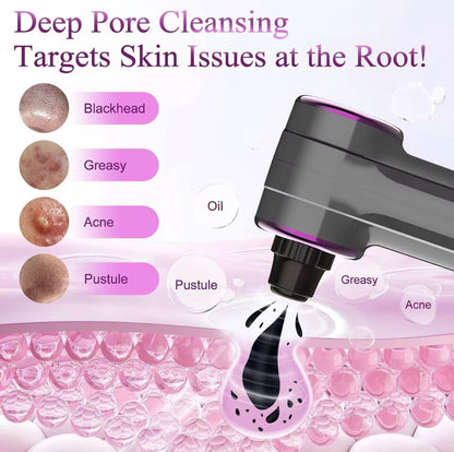 Blackhead Remover Vacuum Deep Pore Cleansing Infographic - Beauty by Ouria | Nettoyage Pores Profond