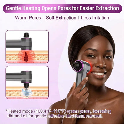 Blackhead Remover Vacuum Heating Opens Pores Woman Using - Beauty by Ouria | Extracteur Chaleur Pores