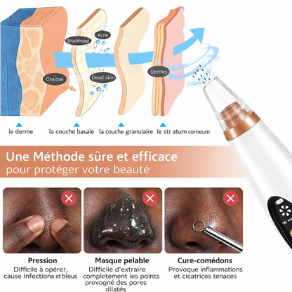 Blackhead Remover Vacuum Safe Suction Method Skin Layers vs Manual Methods - Beauty by Ouria | Aspirateur Méthode Sûre Couches Peau vs Méthodes Manuelles